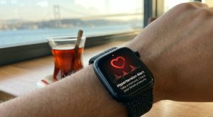 Apple Watch ile Sağlığınıza Dikkat Edin