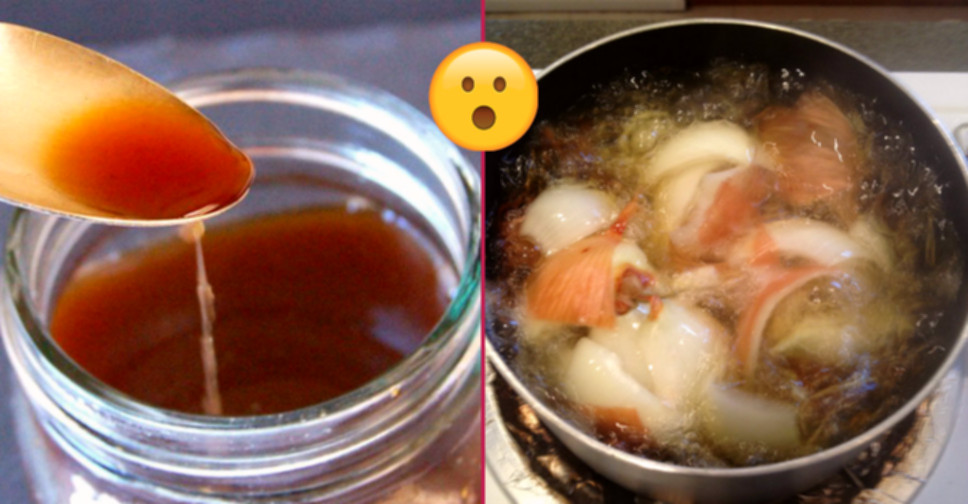 soğan kullanımları