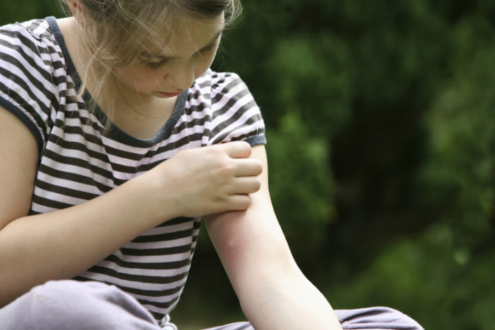 soğanın gizemli dünyası: bilmediğiniz 10 farklı kullanım 33 soğan kullanımları