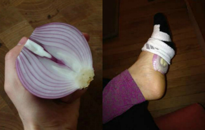 soğanın gizemli dünyası: bilmediğiniz 10 farklı kullanım 31 soğan kullanımları